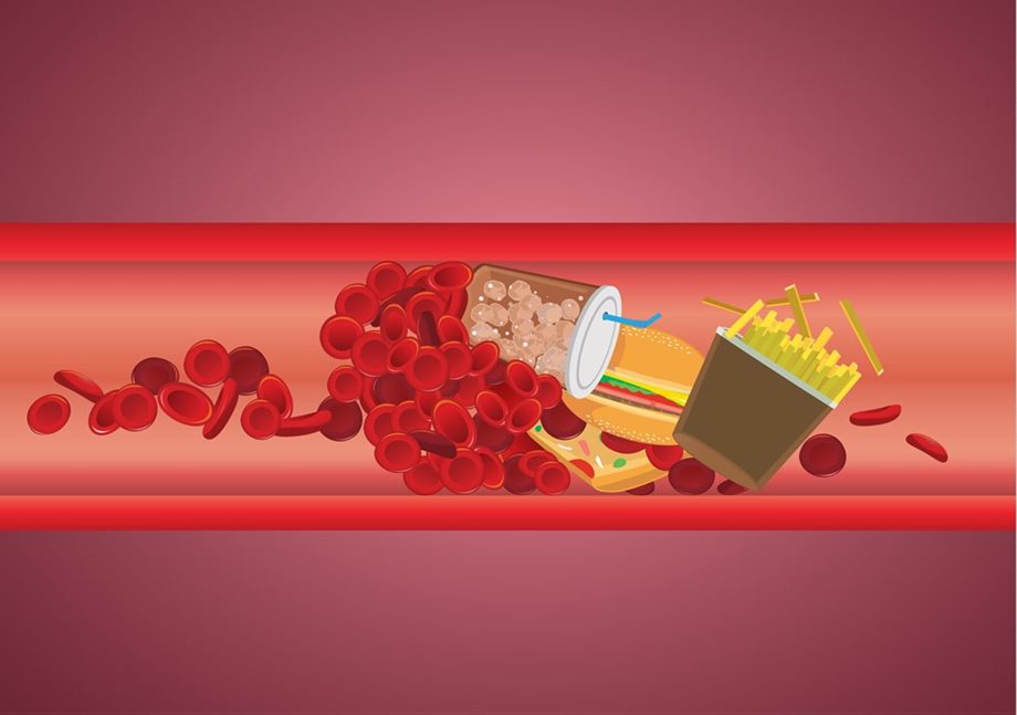 Vyzrajte na cholesterol
